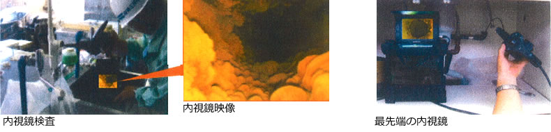 内視鏡